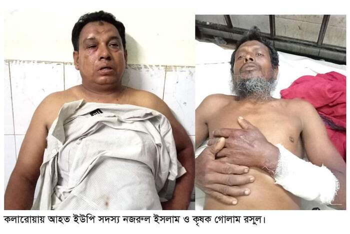 কলারোয়ায় ইউপি সদস্যকে পিটিয়ে হত্যার চেষ্টা